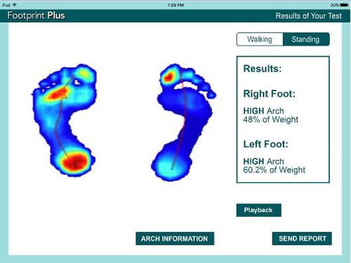 足病学软件 - Footprint Plus™ - Tekscan - 数据管理 / 可视化 / 评估