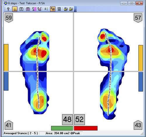足病学软件 - FootMat™ Researchers - Tekscan - 分析 / 可视化 / 报告