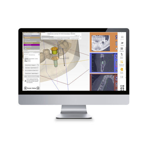 医疗可视化软件 - CAD Software - Zfx GmbH - 设计 / CAD / 医用