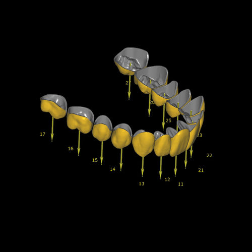 牙科软件模块 - Eggshell Temporary - Zirkonzahn/泽康赞 - 导入 / CAD / CAM