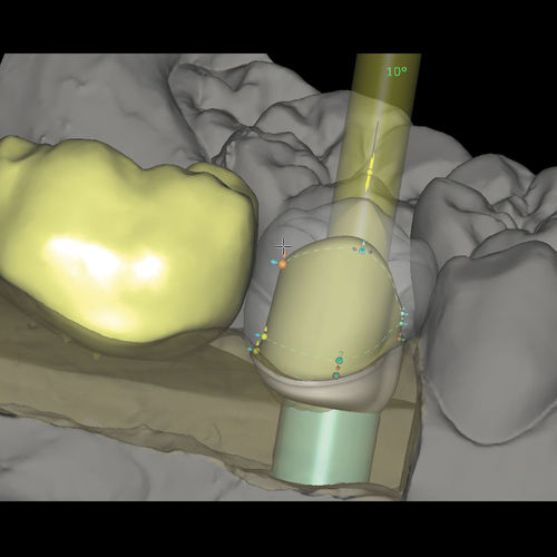 牙科实验室软件模块 - CAD/CAM Abutments - Zirkonzahn - 牙修复体设计 / 生产