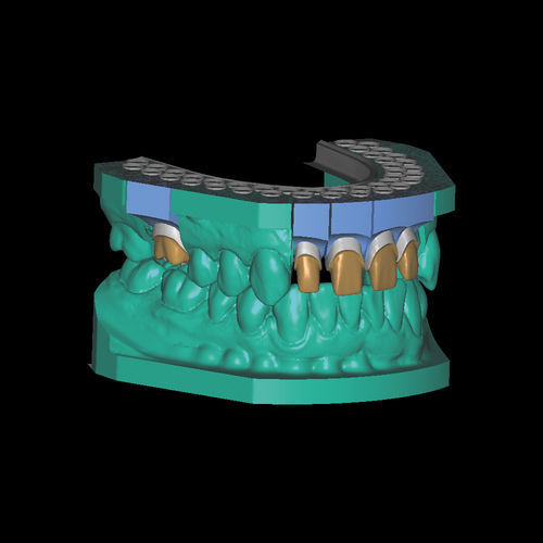 牙科实验室软件模块 - Model-Maker - Zirkonzahn/泽康赞 - 模型制作 / 3D 模拟 / CAD