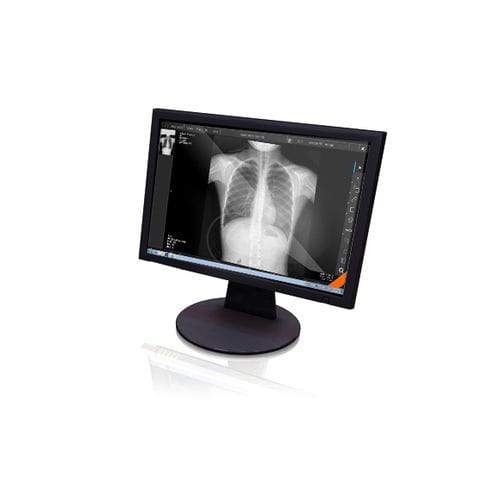 医疗可视化软件 - Xview4 - GEMSS Medical Systems - 用于放射学 / 平板电脑