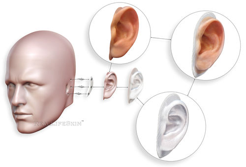 耳廓整形假体 - RealLifeSkin™ - RealLifeSkin - 成人