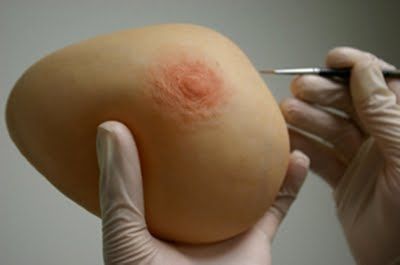 乳腺整形假体 - The Anaplastology Clinic - 成人