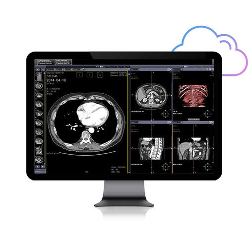 基于网络PACS系统 - Smart Net - Infinitt Healthcare - 医用