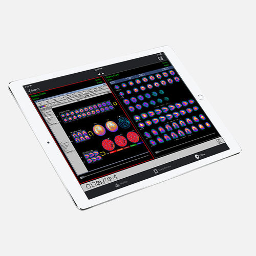 PACS（医学影像系统）iOS应用程序 - iPaxera - PaxeraHealth Corp - 可视化 / 诊断 / 报告