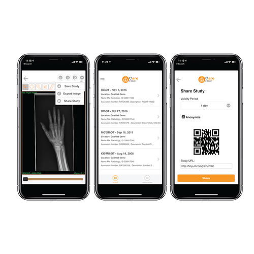 医用共享软件 - CareRad - PaxeraHealth Corp - 图像分析 / 管理 / 控制