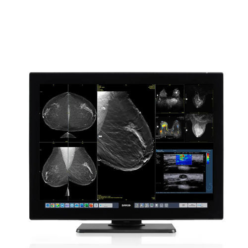 医用显示器 - Coronis OneLook - Barco - 用于放射学 / 乳腺造影 / 远距离