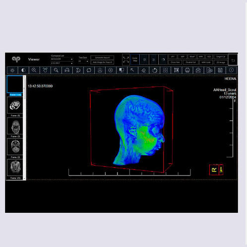 医学成像PACS系统 - Allengers Medical Systems