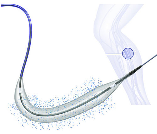 PTA球囊导管 - BIOPATH™ 014 - Biosensors International - 周围神经系统 / 动脉 / 股动脉