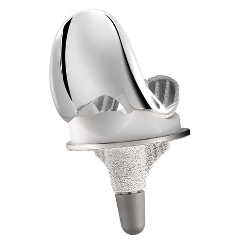 三间隔膝关节假体 - MC2® UC - C2F Implants - 活动轴承 / 骨水泥或非骨水泥