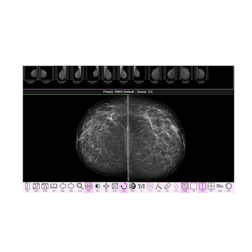 临床软件 - RAFFAELLO  - IMS - 乳腺X射线造影 / 图像分析 / 采集