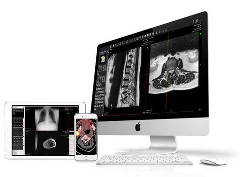 医学报告软件 - Perennity - Rimage EMEA GmbH - 查看 / 诊断 / 共享