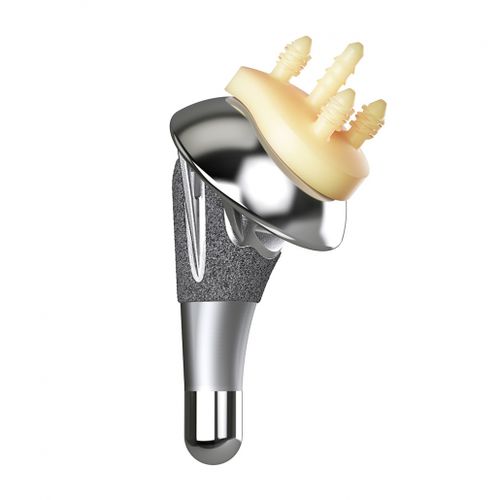 非骨水泥人工肩关节假体 - AltiVate® - Enovis Surgical