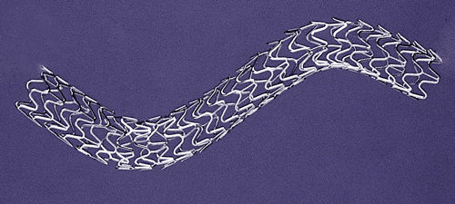 冠状动脉内支架 - ProLink LP - Vascular Concepts - 不锈钢