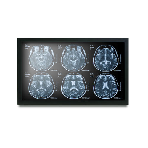 医用显示器 - MEDDP-622 - Onyx Healthcare Inc - 19" / 液晶 / LED背光