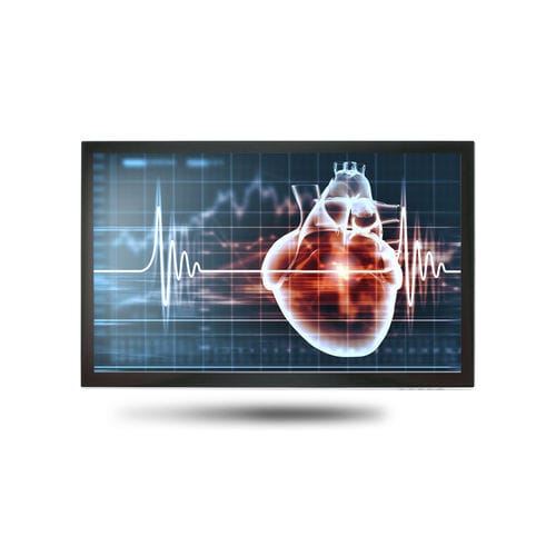 医用显示器 - MEDDP-615 - Onyx Healthcare Inc - 18.5" / 液晶 / LED背光