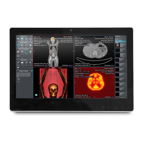 Intel® Celeron®医疗控制面板 - SMA-1533 - Onyx Healthcare Inc - Intel® Atom 双核 / 重症监护科 / 信息设备推车