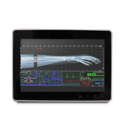 Intel® Celeron®医疗控制面板 - SMA-1033 - Onyx Healthcare Inc - Intel® Atom 双核 / 一体机 / 射频技术