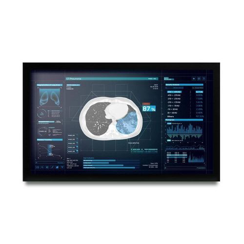 医用显示器 - MEDDP-627 - Onyx Healthcare Inc - 全高清Full HD / 1920 x 1080 / 27"