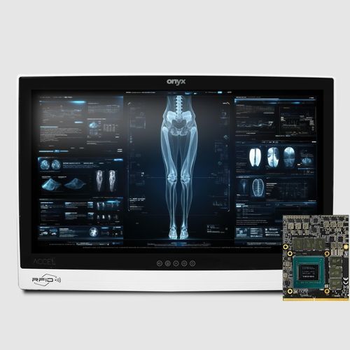 Intel® Core™ i9医疗电脑 - ACCEL-A2720 - Onyx Healthcare Inc - 医疗成像 / 一体机 / 人工智能协助