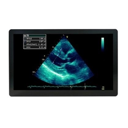 超声波成像显示器 - MSBP2416AMC - Avalue Healthcare - 手术 / 1920 x 1080 / 24"