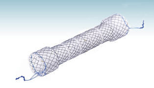 食道内支架 - HANAROSTENT®BS (CCC) - M.I Tech