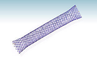 结直肠内支架 - HANAROSTENT® NNN - M.I Tech