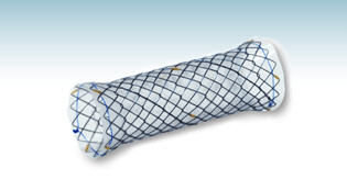 气管内支架 - HANAROSTENT®(CCC) - M.I Tech