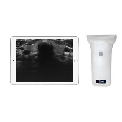 手持式B超机 - Sonostar Technologies - 用于多功能超声检查 / 黑白 / 彩色多普勒