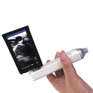 手持式B超机 - XProbe - Sonostar Technologies - 用于多功能超声检查 / 黑白 / 无线探头