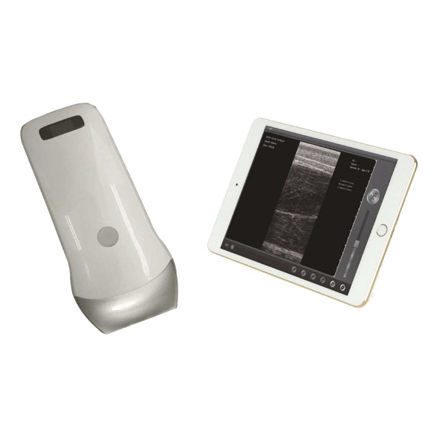 兽医超声波检查仪 / 手持式 - UProbe-2B - Sonostar Technologies - 多功能 / 用于猫科动物 / 无线探头