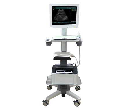 紧凑型平台B超机 - SS-100 Touch Screen Trolley Ultrasound Diagnosis B - Sonostar Technologies - 用于多功能超声检查 / 彩色多普勒