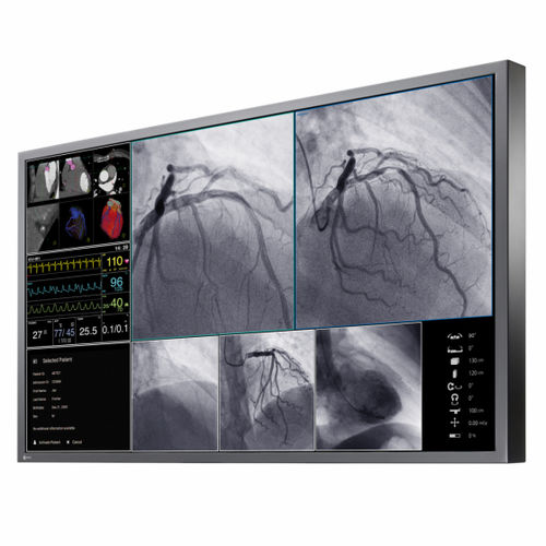 医学成像显示器 - LL550W - EIZO GmbH - 用于放射学 / 血管造影术 / 手术室