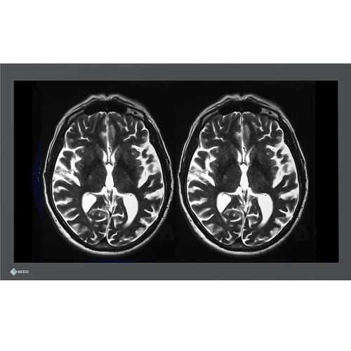医用显示器 - LX3240-MR - EIZO GmbH - 全高清Full HD / 4K分辨率 / 16:9