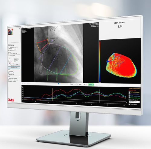 图像分析软件 - Pie Medical Imaging - 诊断 / 测量 / 治疗计划制定