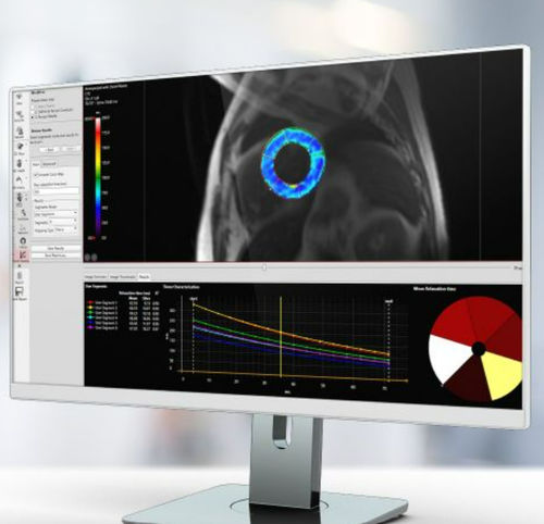 分析软件 - Pie Medical Imaging - 可视化 / 医用 / 临床