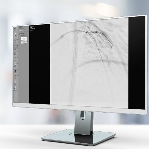 图像优化软件 - StentEnhancer - Pie Medical Imaging - 可视化 / 医用 / 心脏