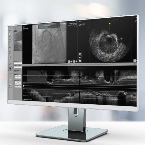 医疗可视化软件 - IV-LINQ - Pie Medical Imaging - 血管造影术 / 平板电脑