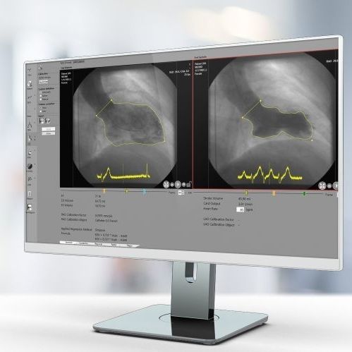 分析软件 - RVA - Pie Medical Imaging - 报告 / 校准 / 用于检测轮廓