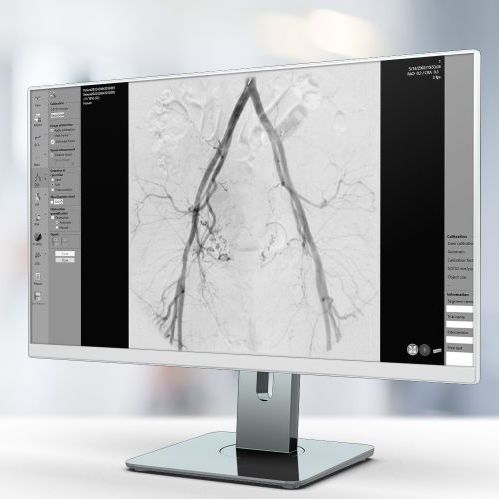 分析软件 - QVA - Pie Medical Imaging - 报告 / 加工 / 评估