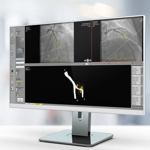 分析软件 - QCA  - Pie Medical Imaging - 报告 / 校准 / 用于检测轮廓