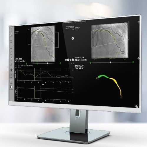 分析软件 - vFFR - Pie Medical Imaging - 3D 可视化 / 医用 / 用于医院