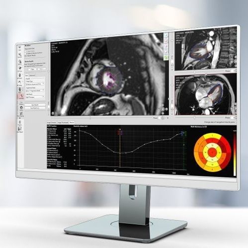 分析软件 - Pie Medical Imaging - 报告 / 医用 / 核磁共振MRI