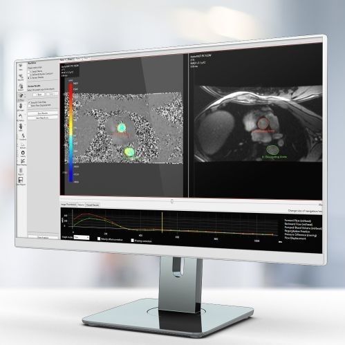 分析软件 - Pie Medical Imaging - 报告 / 可视化 / 检查用