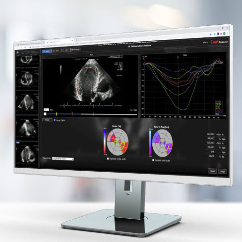 分析软件 - Qardia - Pie Medical Imaging - 报告 / 测量 / 医用