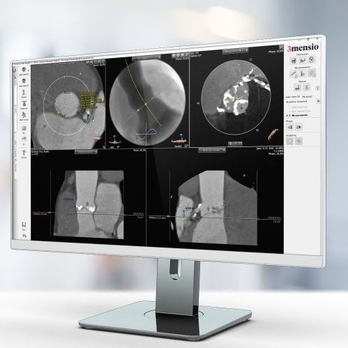 分析软件 - Pie Medical Imaging - 报告 / 可视化 / 测量