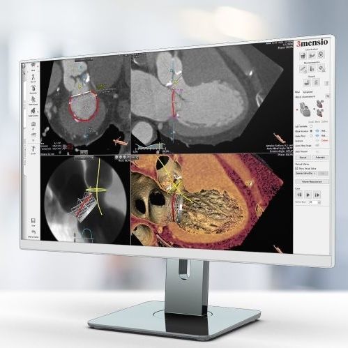 分析软件 - Pie Medical Imaging - 报告 / 可视化 / 规划