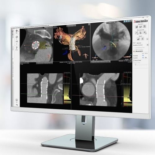 医学报告软件 - Pie Medical Imaging - 规划 / 加工 / 用于医院